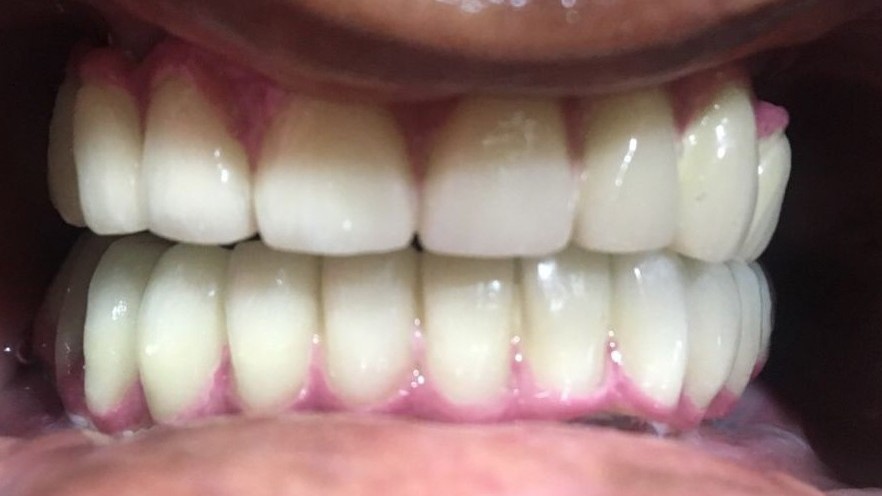 After Image